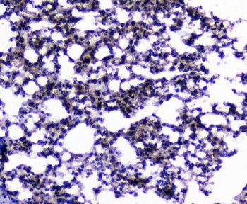 Anti-CIC Antibody