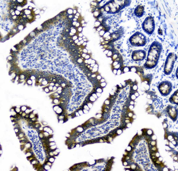 Anti-CIC Antibody