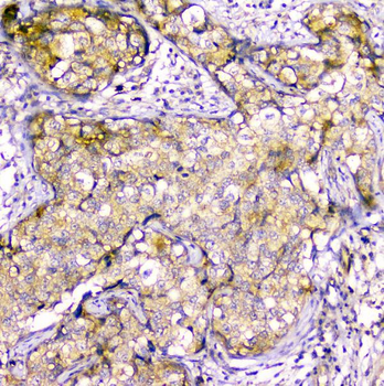 Creatine Kinase MM/CKM Antibody