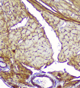 Anti-Creatine Kinase MM/CKM Antibody