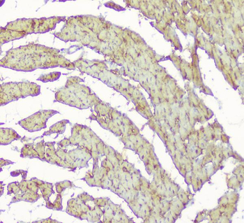Anti-Creatine Kinase MM/CKM Antibody