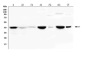 Anti-Creatine Kinase MM/CKM Antibody