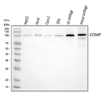 Anti-COMP Antibody