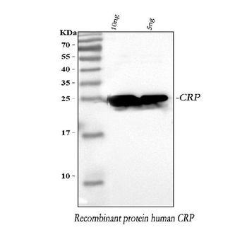 Anti-C Reactive Protein/CRP Antibody
