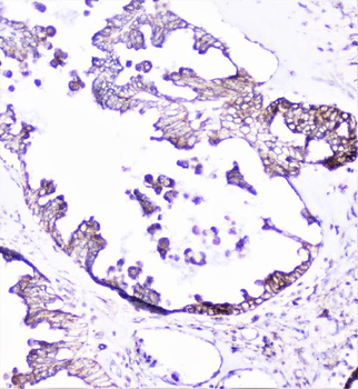 Anti-Cortactin/CTTN Antibody
