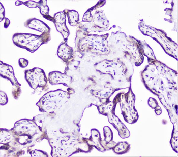Anti-Cortactin/CTTN Antibody