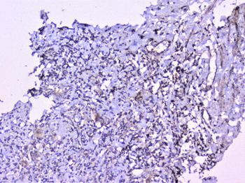 Anti-Cortactin/CTTN Antibody