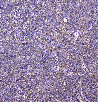 Anti-Cortactin/CTTN Antibody