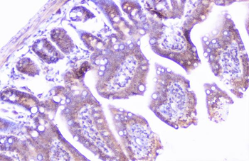 Anti-Cortactin/CTTN Antibody