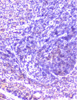 Anti-Cortactin/CTTN Antibody