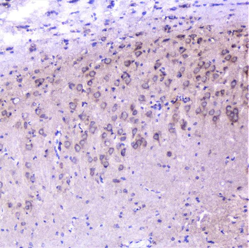 Anti-Cortactin/CTTN Antibody