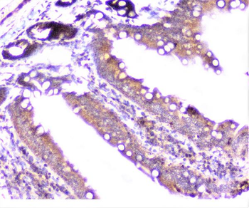 Anti-Cortactin/CTTN Antibody