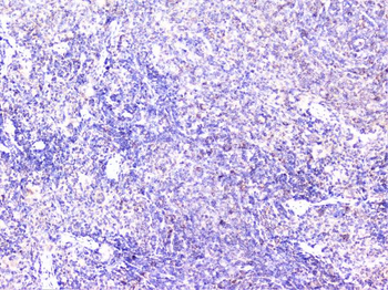 Anti-Cortactin/CTTN Antibody