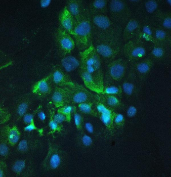 Anti-Cortactin/CTTN Antibody