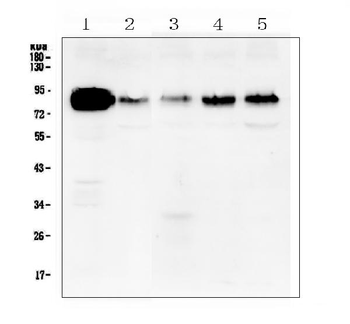 Anti-Cortactin/CTTN Antibody