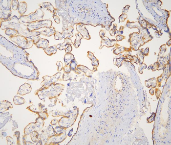 Anti-Cortactin/CTTN Antibody