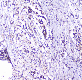 Anti-Cortactin/CTTN Antibody