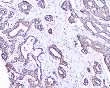 Anti-Cortactin/CTTN Antibody