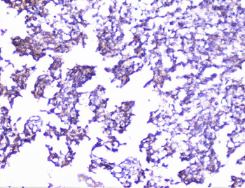 Anti-Cortactin/CTTN Antibody