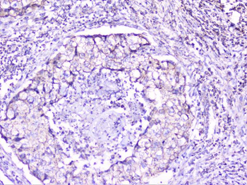 Anti-Cortactin/CTTN Antibody
