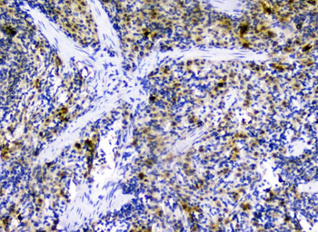 Anti-CXCL12 Antibody