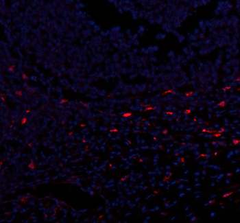 Anti-CXCL12 Antibody