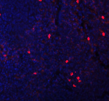 Anti-CXCL12 Antibody