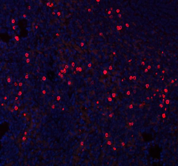 Anti-CXCL12 Antibody