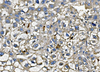 Anti-CXCL12 Antibody