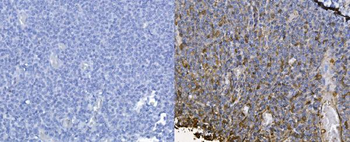 Anti-CXCL12 Antibody