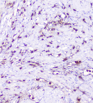 Anti-CXCL12 Antibody