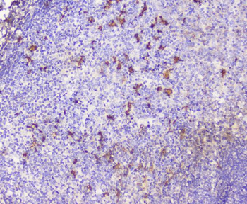 Anti-CXCL12 Antibody