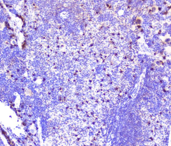 Anti-CXCL12 Antibody