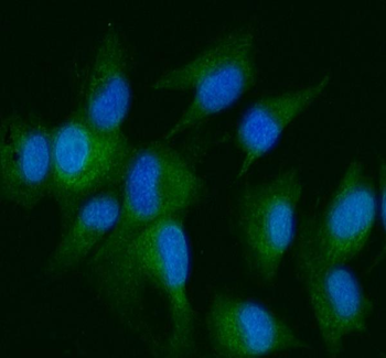 Anti-DDR2 Antibody