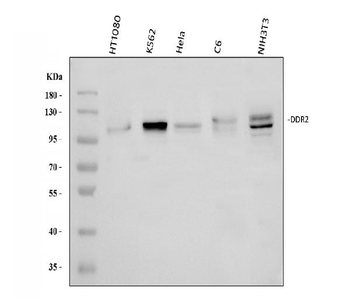 Anti-DDR2 Antibody