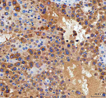 Anti-DDT Antibody