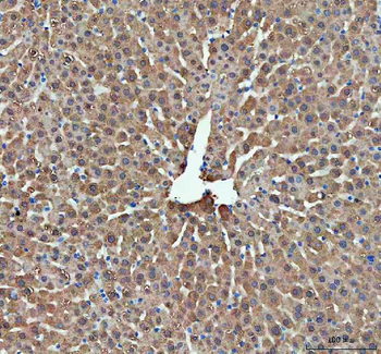 Anti-DDT Antibody