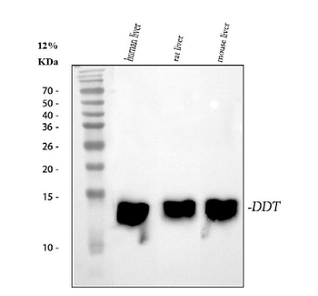 Anti-DDT Antibody