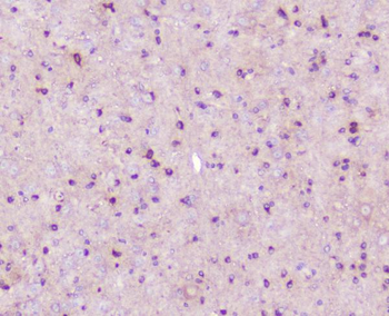 ELAVL2 HuB Antibody