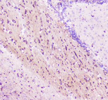 ELAVL2 HuB Antibody