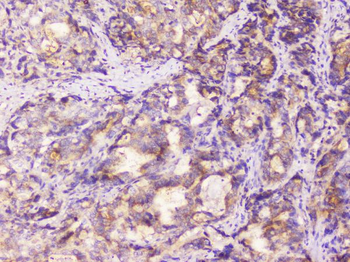 Anti-EML4 Antibody
