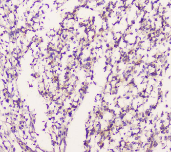 Anti-EML4 Antibody