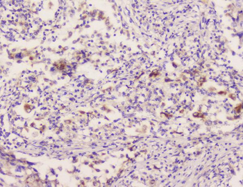 Anti-EML4 Antibody