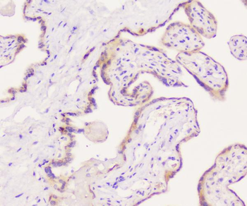 Anti-EML4 Antibody