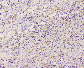 Anti-EML4 Antibody