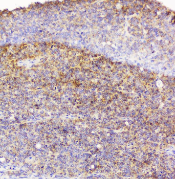 Anti-EML4 Antibody