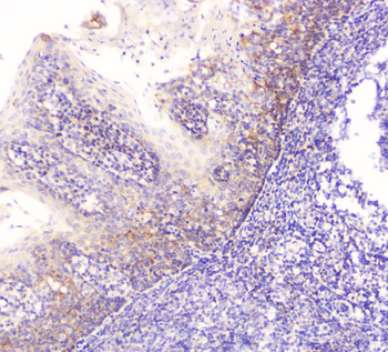 Anti-EML4 Antibody