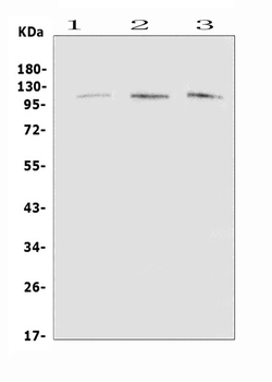 Anti-EML4 Antibody