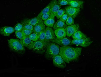 Anti-NSE/ENO2 Antibody