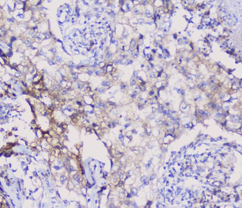 Anti-NSE/ENO2 Antibody